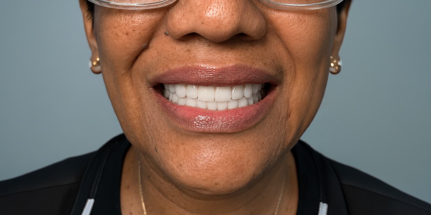 Rehabilitación oral completa
