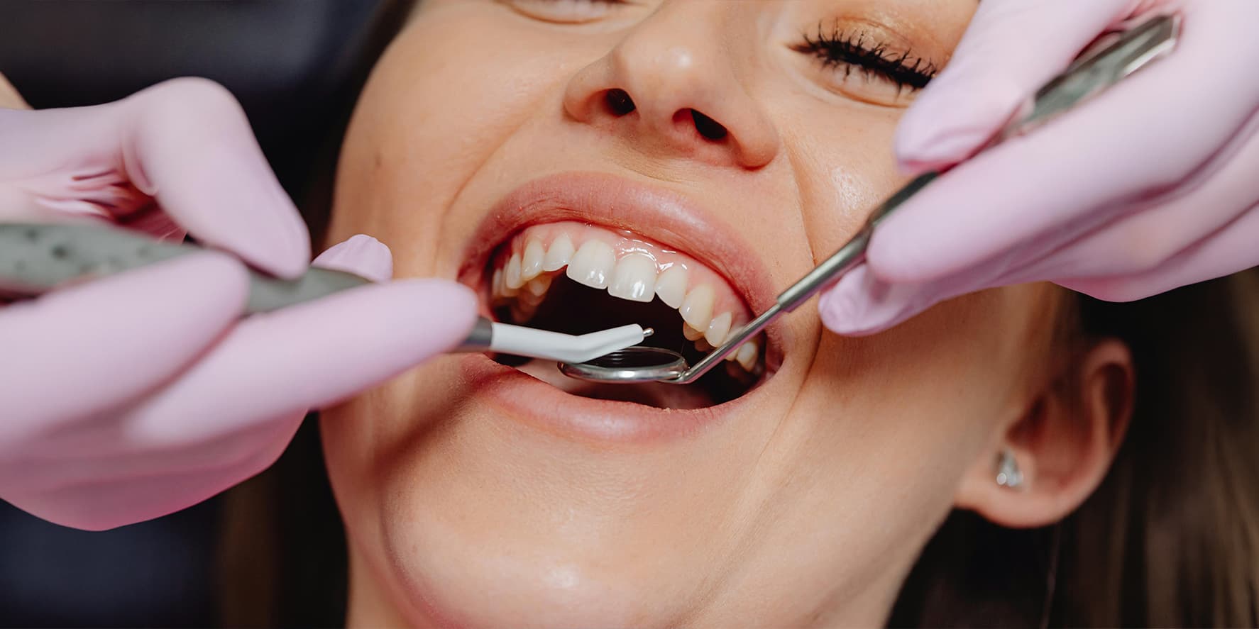 Rehabilitación oral
